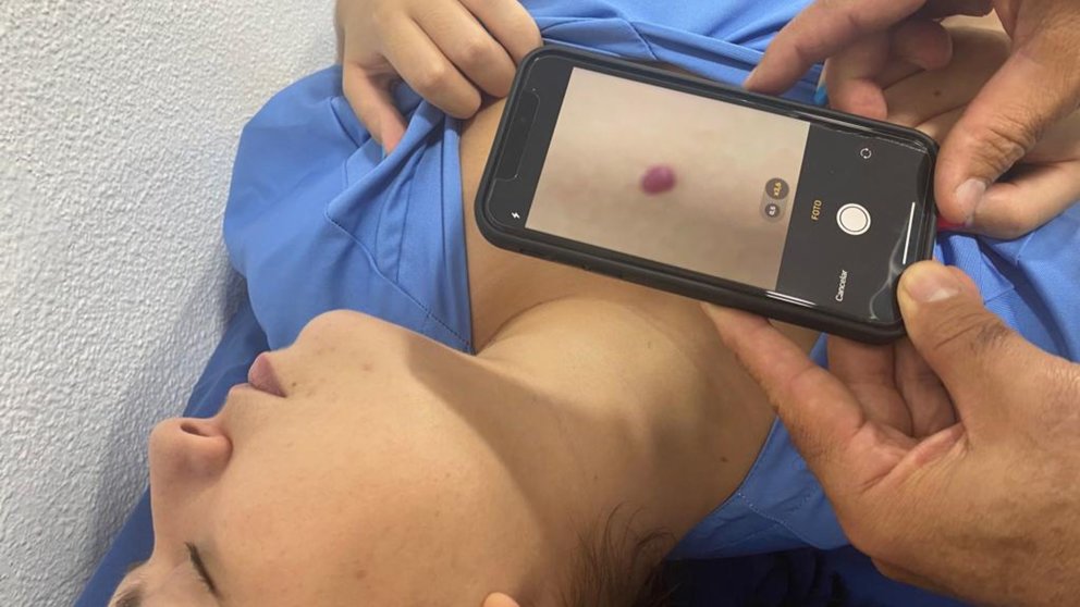 Ribera Hospital de Molina incorpora la inteligencia artificial para diagnosticar y tratar lesiones en la piel