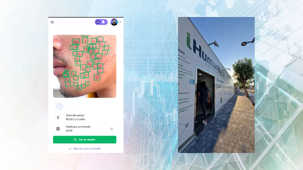 iHumanity incorpora la IA para diagnósticos de dermatología en sus centros de Murcia y San Javier