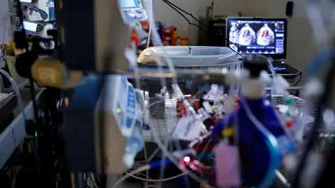 CaixaResearch Placenta Artificial logra una supervivencia de 12 d&iacute;as con buen estado fetal