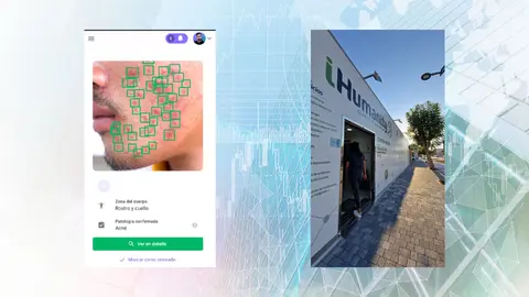 iHumanity incorpora la IA para diagn&oacute;sticos de dermatolog&iacute;a en sus centros de Murcia y San Javier