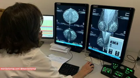 La nueva metodolog&iacute;a permitir&aacute; ganar en precisi&oacute;n, complementando el trabajo de los profesionales en la detecci&oacute;n del c&aacute;ncer de mama.